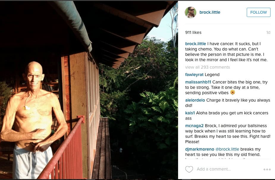Brock Little: &Quot;I Have Cancer. It Sucks.” 1 Screen shot 2016-01-30 at 5. 42. 56 pm
