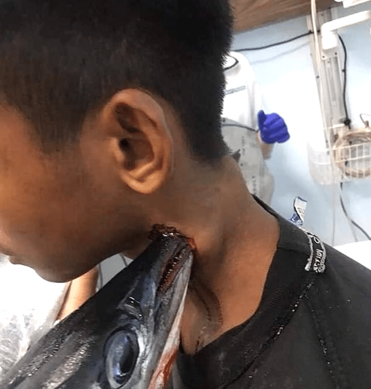 Fanaticism Brave Indonesian Teenager Survives Unprovoked Stabbing