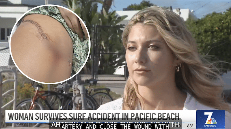 Allie Brieghner (pictured) lucky to be alive. Photo: NBC 7 News