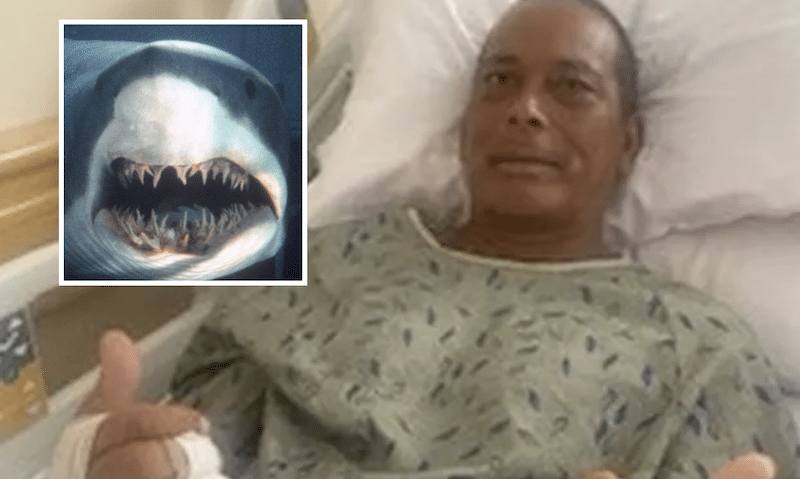 Shark attack survivor Kevin Kanehe