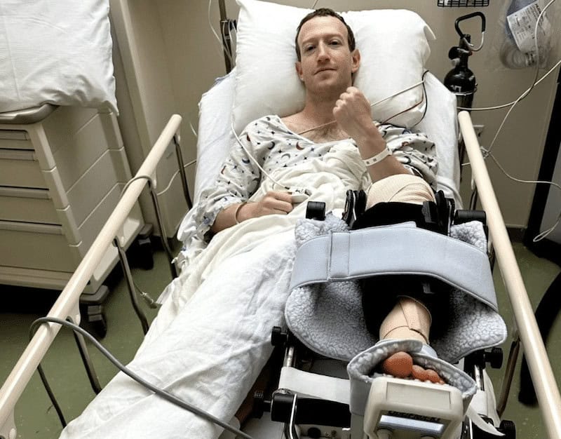 Accident-Prone Mark Zuckerberg Reveals &Quot;Multiple Surfing Injuries&Quot; Prior To Destroying Knee! 1 Mark zuckerberg in hospital with acl repair.