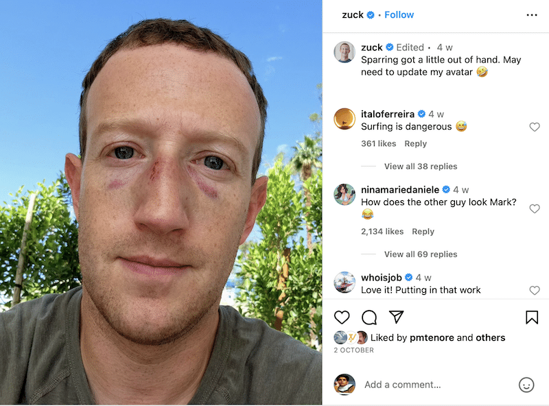 Mark Zuckerberg with sparring injured