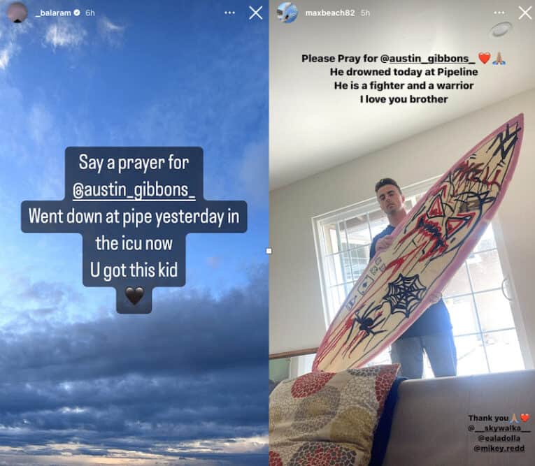 Austin Gibbons, injured at Pipeline