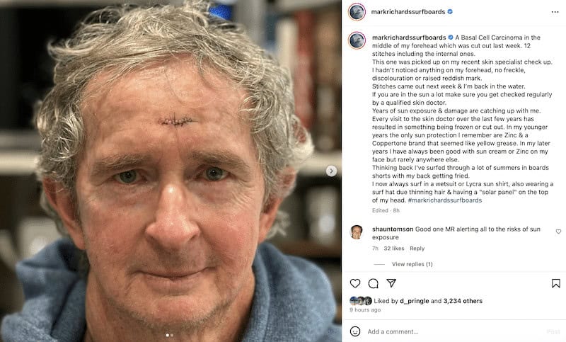 Surf Legend Delivers Full-Throated Attack On Big Solar 1