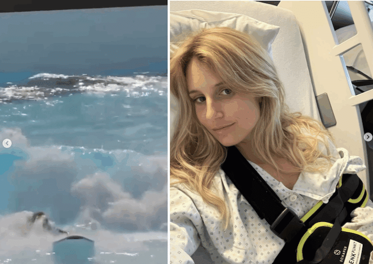 Wave pools claim yet another victim as decorated Olympian Anna Gasser has arm ripped from socket in Munich