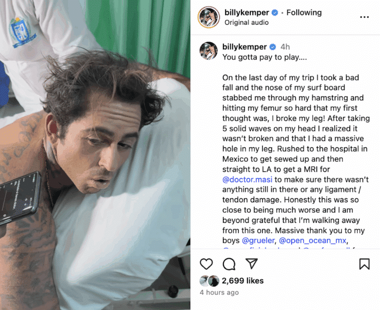 Surf community rallies around big-wave champ Billy Kemper gruesomely injured in Mexican wipeout