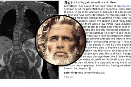 Kelly Slater shares shocking health update.